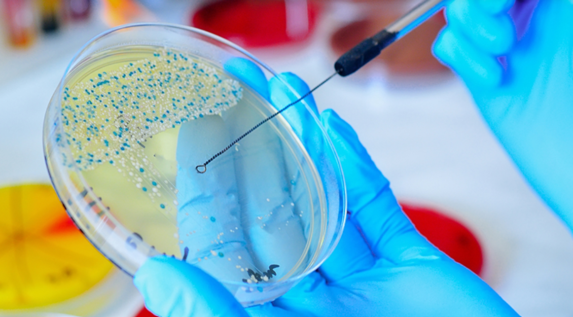Source: https://www.medicalbuyer.co.in/now-its-up-to-microbiology-to-catch-up-on-automation/